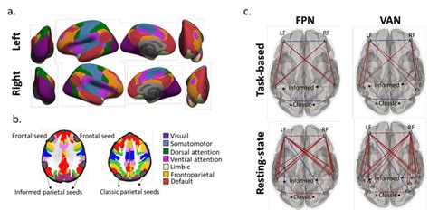 Network-based connectivity: a. Large-scale network parcellation is ...